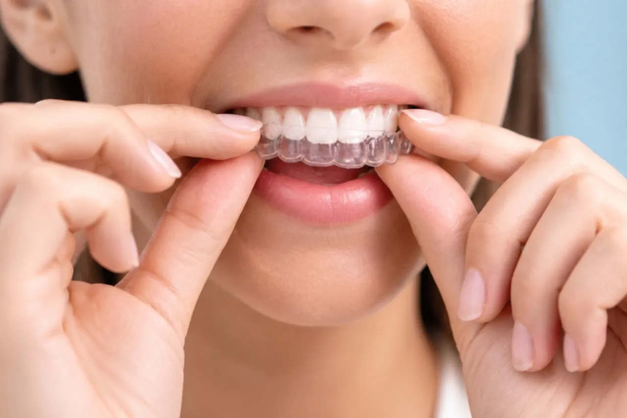 Invisalign